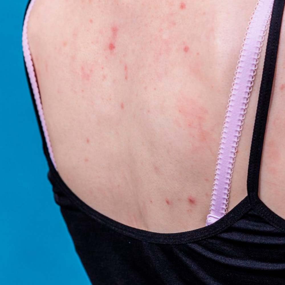 Pack 2 Jabón Natural De Lavanda - Indicado Para Después Del Afeitado - Piel Sensible, Seca Y Dañada - Reduce El Acné_5