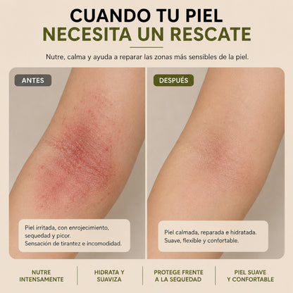 Bálsamo Maravilla Bio | Reparador Piel Dañada, Eccemas, Picor 50ml_5