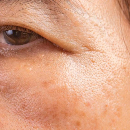 Jabón Natural De Aloe Vera (90g) - Indicado Para Todo Tipo De Piel - Hidrata, Aclara Manchas Y Reduce Estrías_3