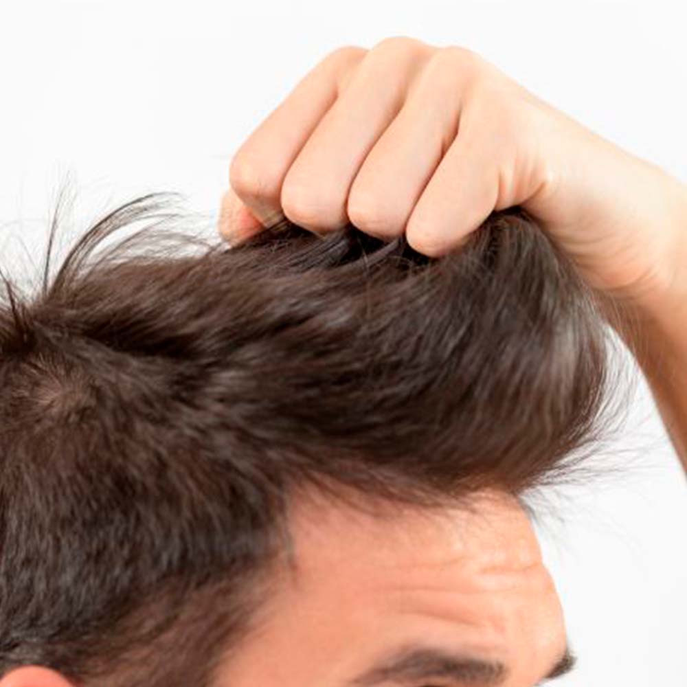 Pack 2 Champú Sólido Anticaída y Fortalecedor - 100% Natural - Todo Tipo de Cabello - Con Aceite de Ricino_2