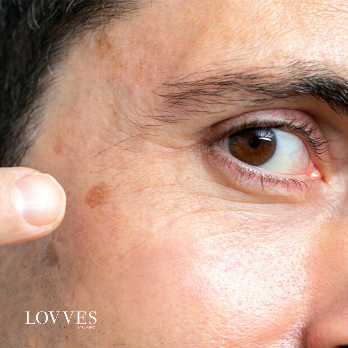 Lovves Sérum Aclarante Manchas Faciales Despigmentante 30ml_4