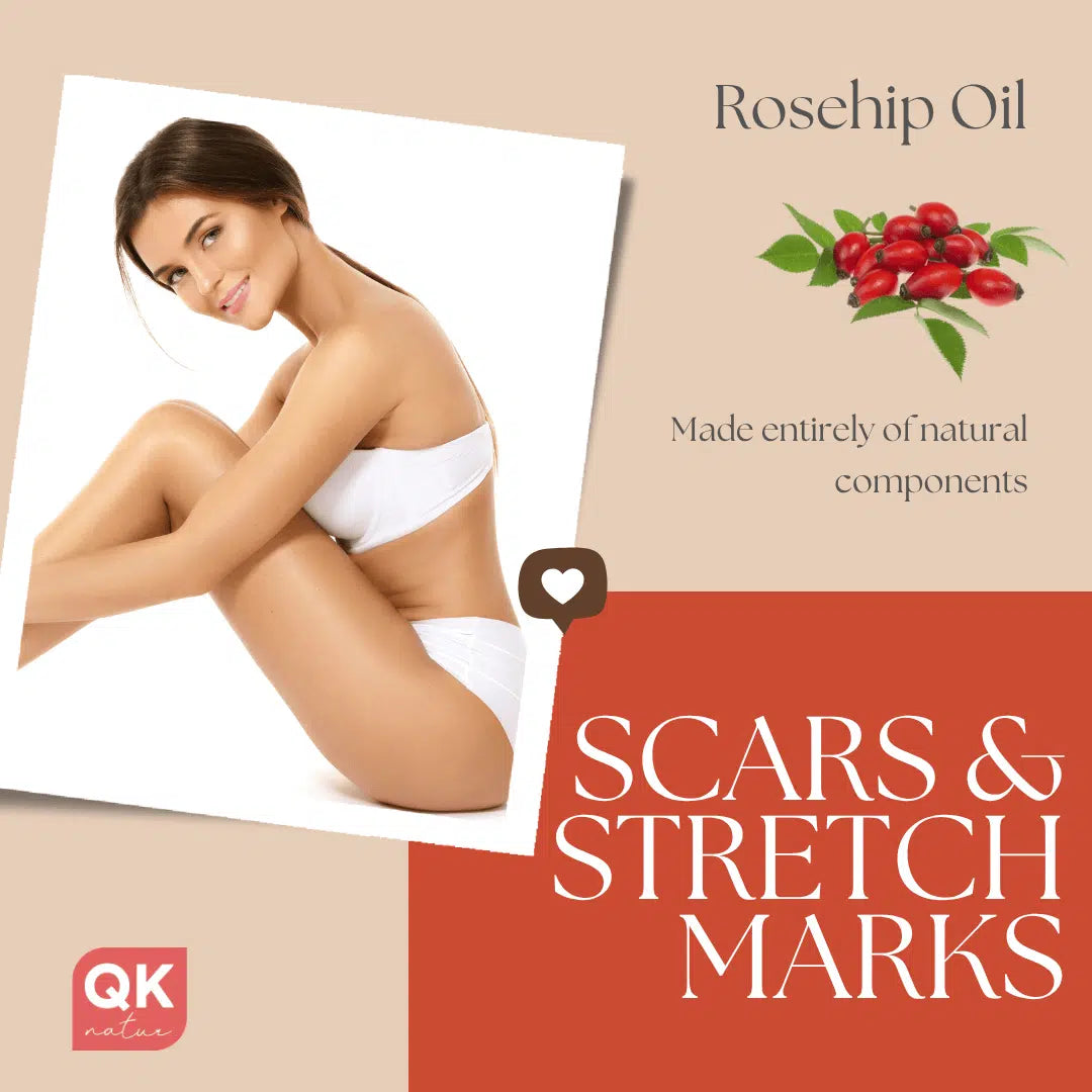 QKnatur - Aceite De Rosa Mosqueta Orgánico 250 ml - Para Cicatrices Y Estrías - Cara Y Cuerpo - Antiarrugas Y Antiedad_1