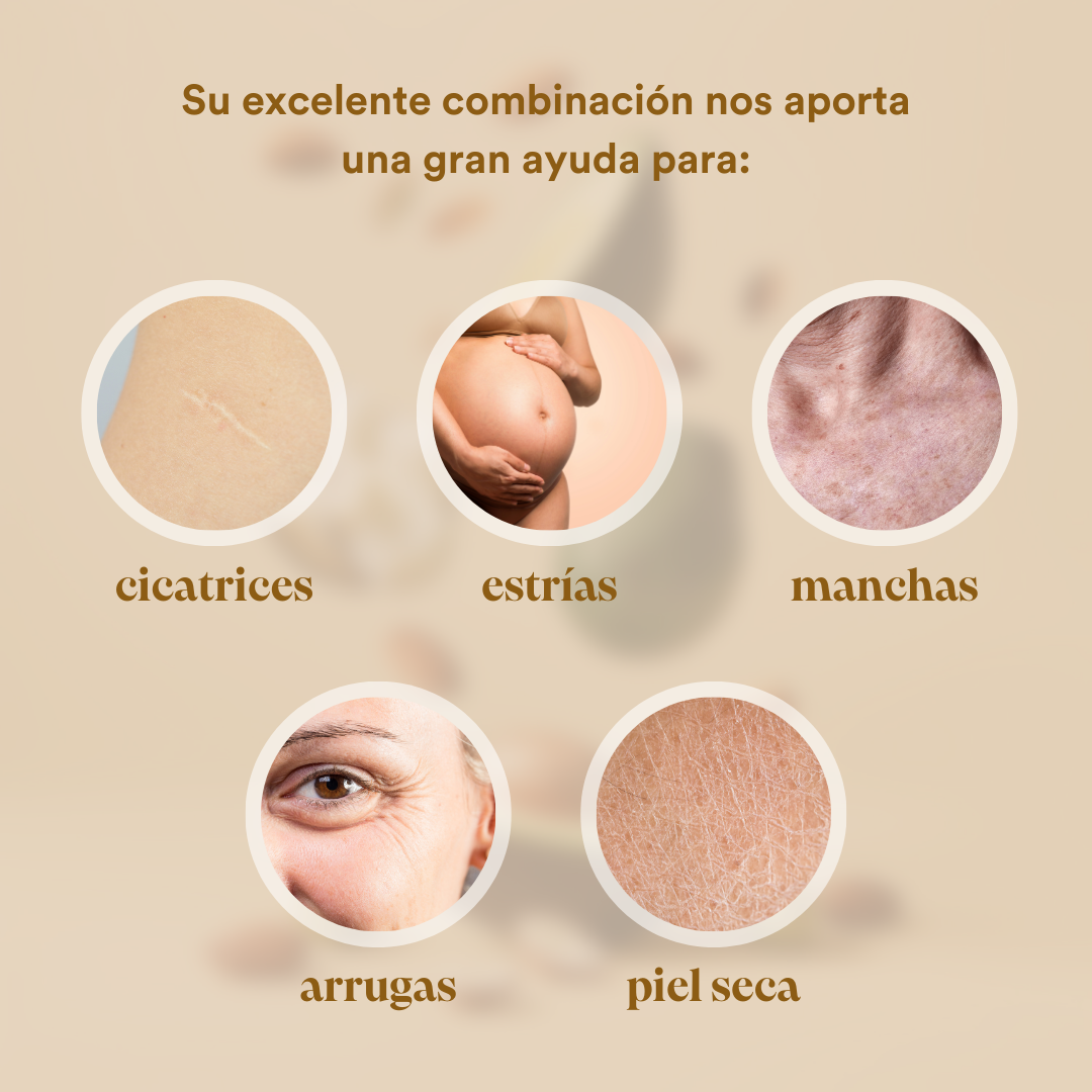 QKnatur - Aceite Corporal All In One - 200ml - Mejora La Apariencia De Cicatrices | Prevención De Manchas Y Estrías_2