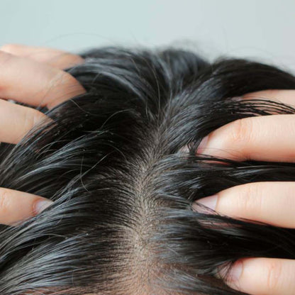 Pack 2 Champú Sólido Anticaspa - 100% Natural - Con Brea - Elimina Caspa Y Alivia Los Picores. Hecho En España_3