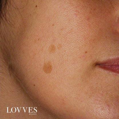 Lovves Sérum Aclarante Manchas Faciales Despigmentante 30ml_3