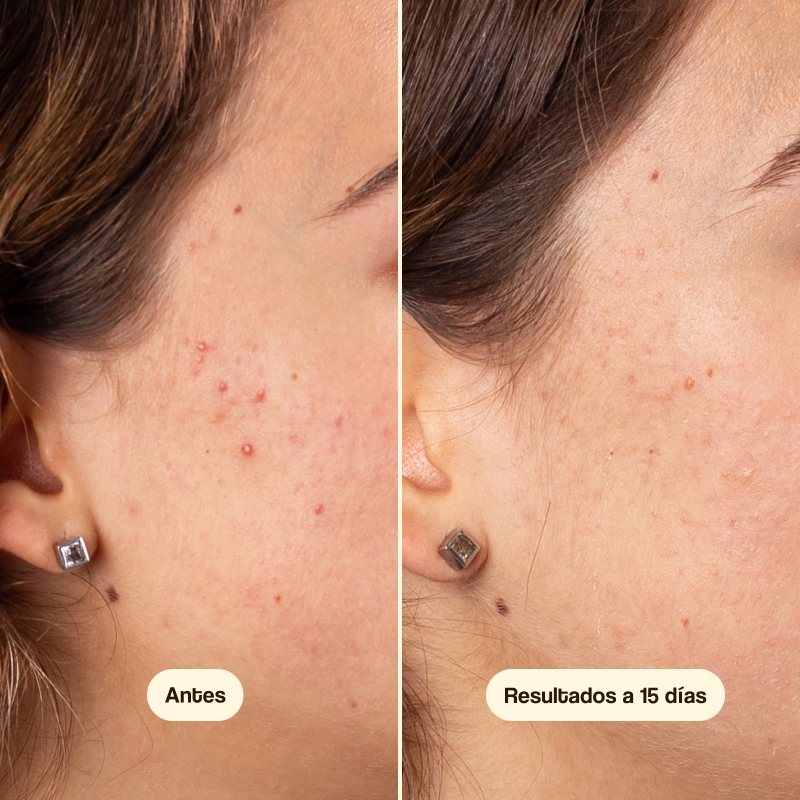 Crema Facial Azelaic Radiance Face Serum Freshly 50ml