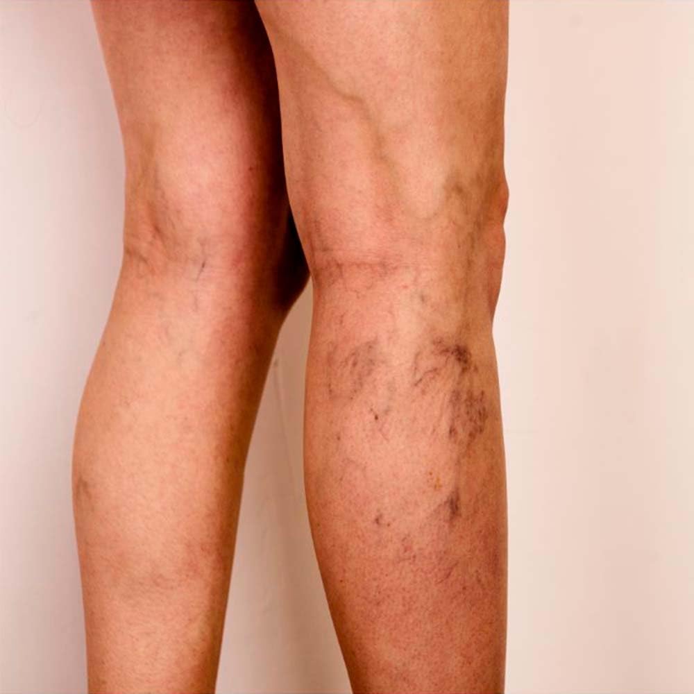 Jabón Natural Algas Marinas 90g - Activa Circulación En Piernas Cansadas - Exfoliante Y Anticelulítico - Para Cuerpo_5