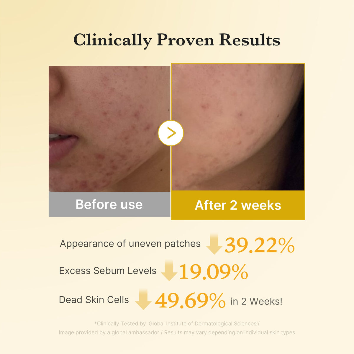 Kojic Turmeric Pad Medicube 70 uds