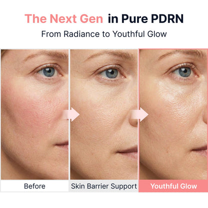 Pink PDRN Glow Boosting Ampoule Sungboon Editor 40 ml