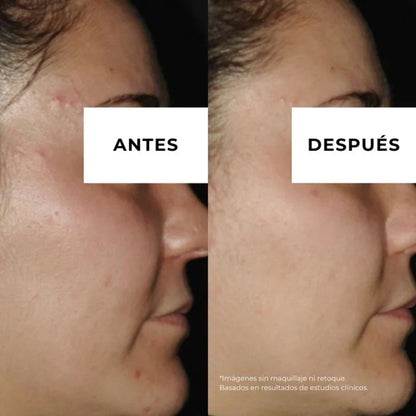 Equilibrium crema antiacné pieles grasas Arganour 30ml