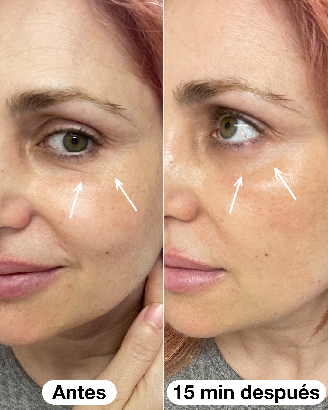 Sérum Roll-on Eye_2