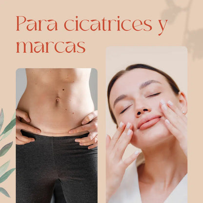 QKnatur - Aceite De Rosa Mosqueta Orgánico 250 ml - Para Cicatrices Y Estrías - Cara Y Cuerpo - Antiarrugas Y Antiedad_3